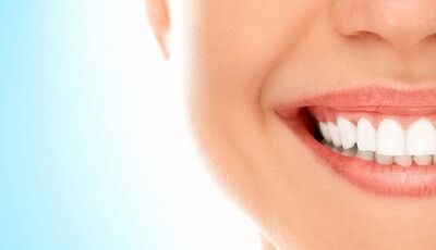 Карієс зубів: причини, профілактика та лікування